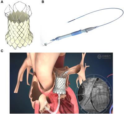 Hemodynamics of the VenusP Valve System™—an in vitro study